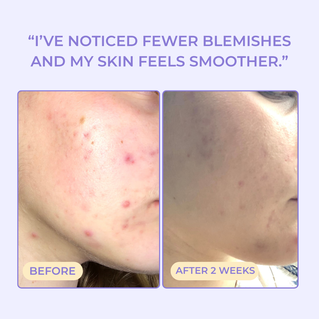 Face Up To It Clarifying Dry Oil