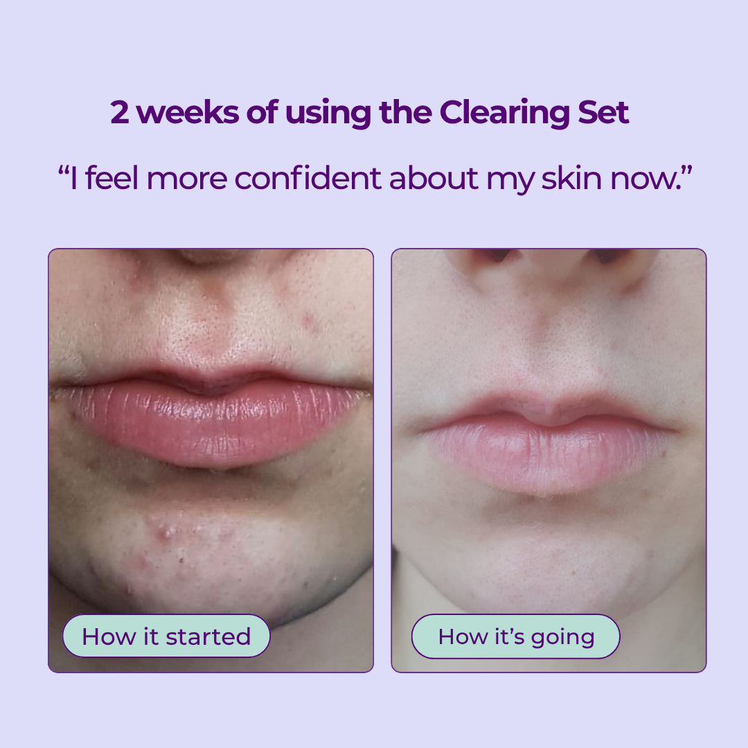 3-Step Clearing Set