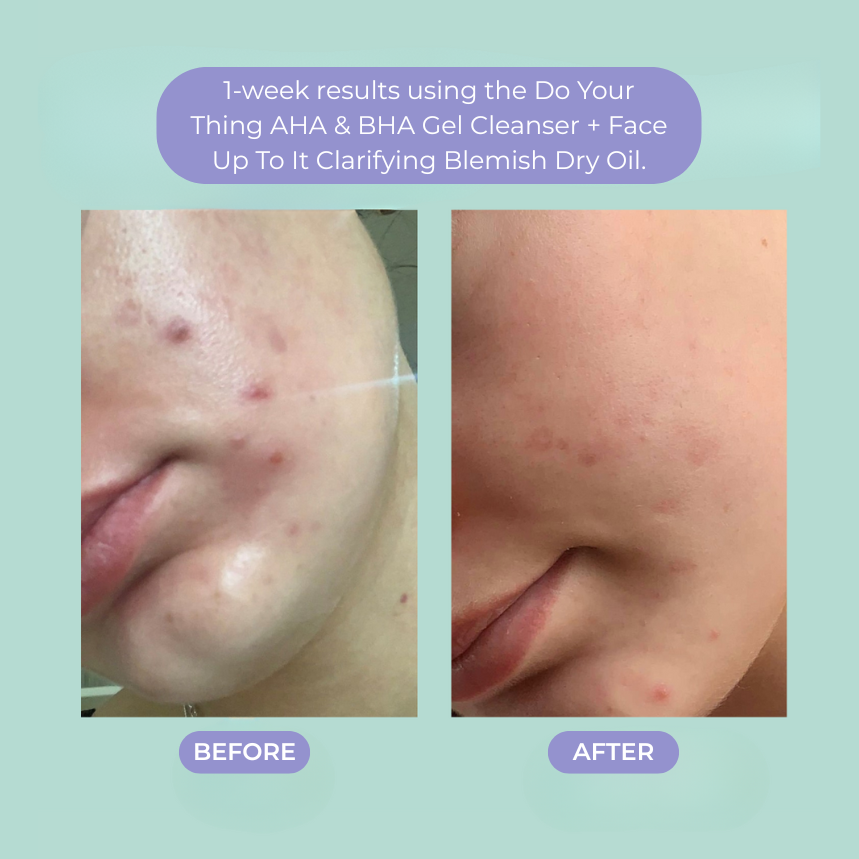 Do Your Thing AHA & BHA Gel Cleanser for Oil Control 3.4 fl oz