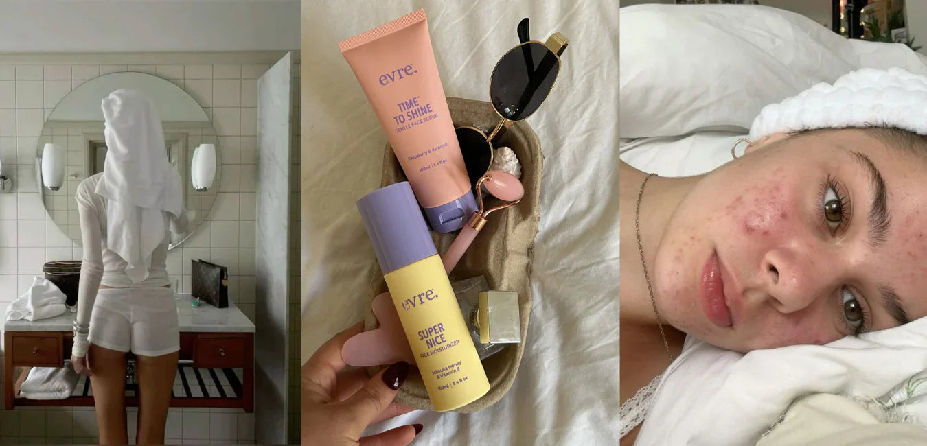 Hormonal Breakouts 101: Why Acne Gets Worse Around Your Period (and What Teens Can Do)