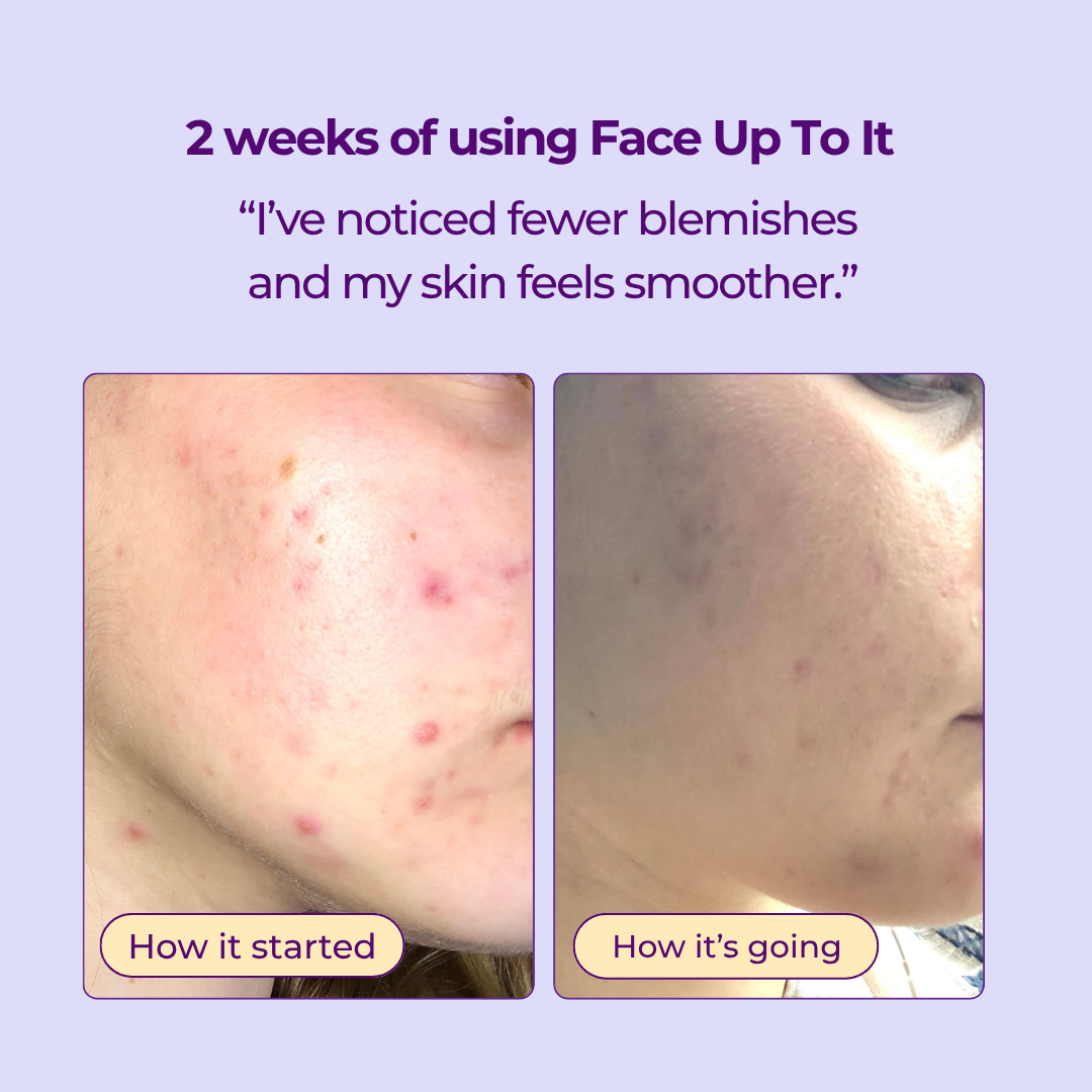 Face Up To It Clarifying Dry Oil