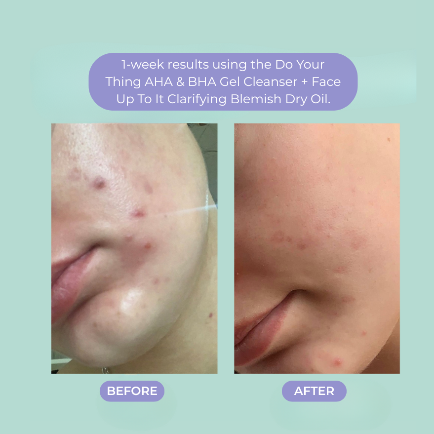 Face Up To It Clarifying Dry Oil 1 fl oz