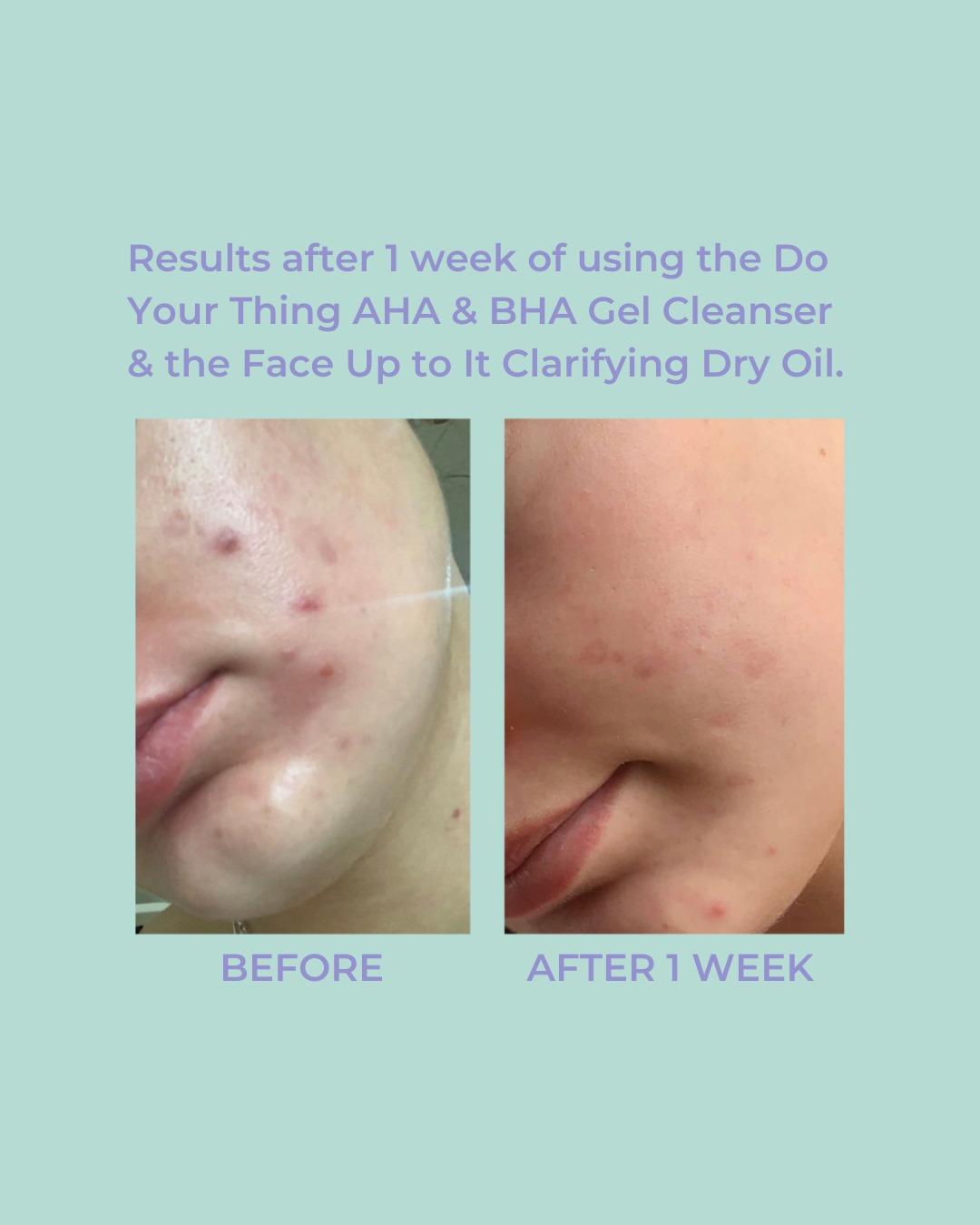 Clearing Set + Moisturizer