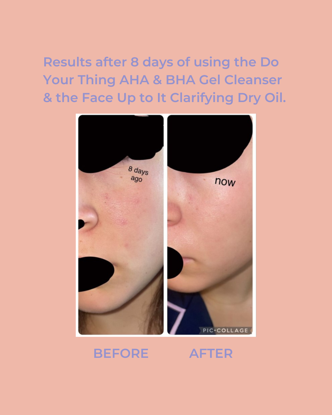 Face Up To It Clarifying Dry Oil 1 fl oz